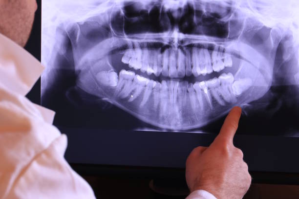 Best Emergency Tooth Extraction in St Ansgar, IA