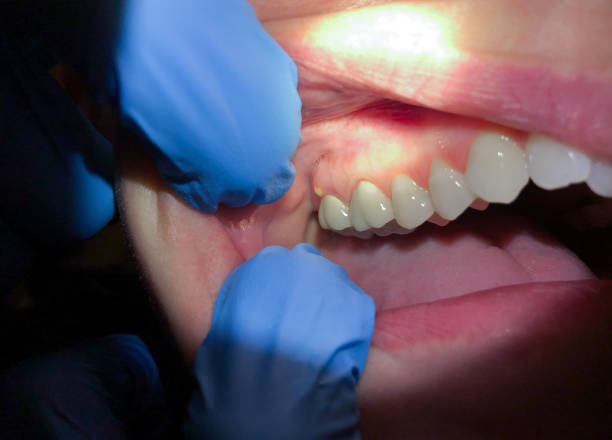 Best After-Hours Emergency Dentist in St Ansgar, IA