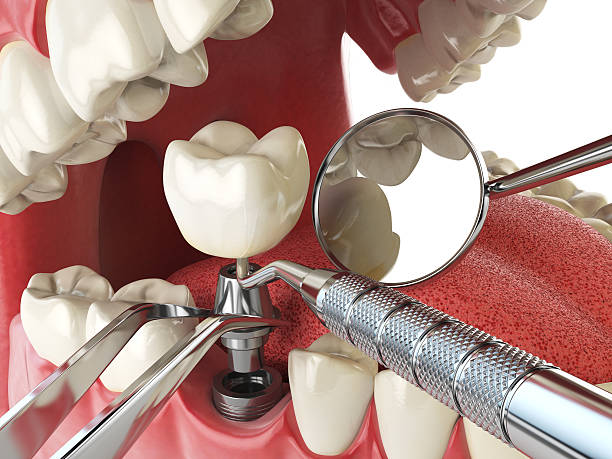 Best Emergency Treatment for Toothache in St Ansgar, IA